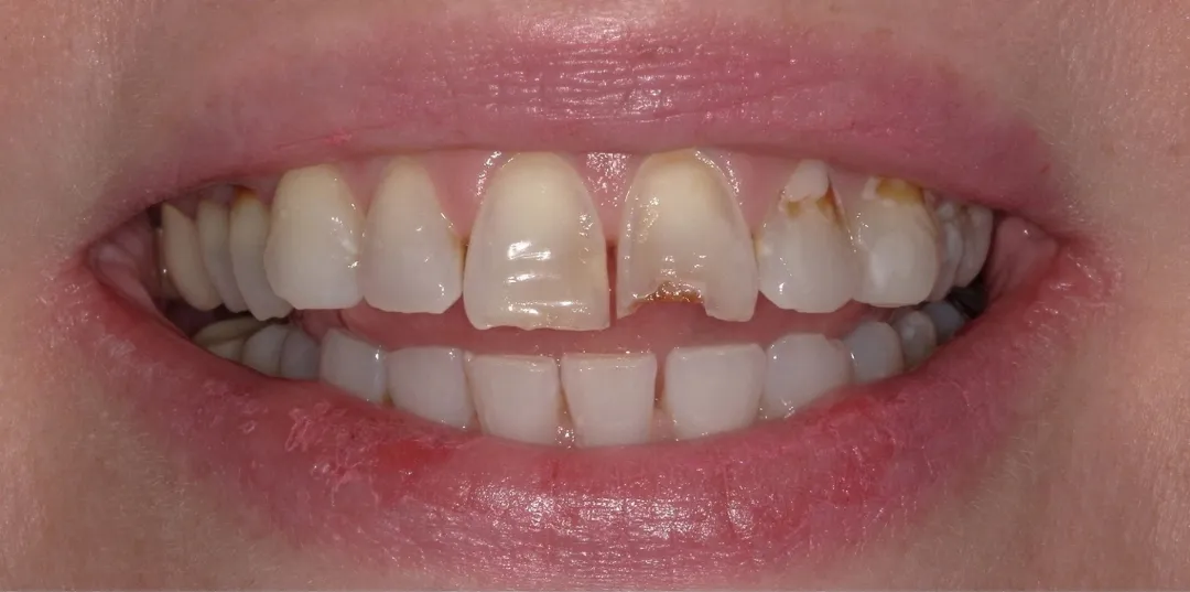 before and after treatment