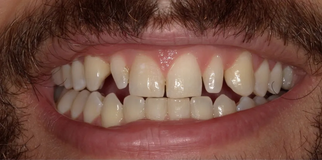 before and after treatment
