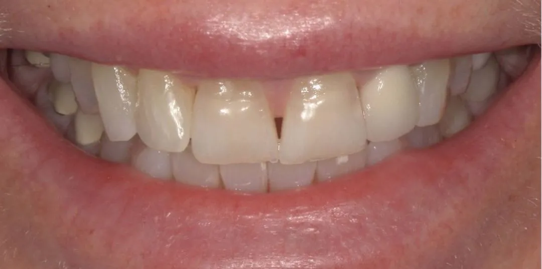 before and after treatment