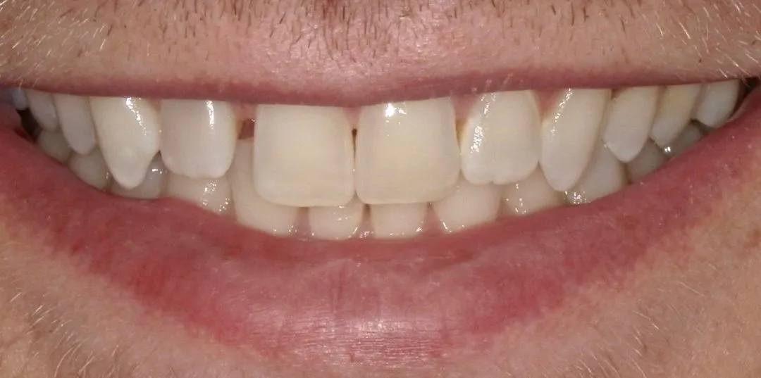 before and after treatment