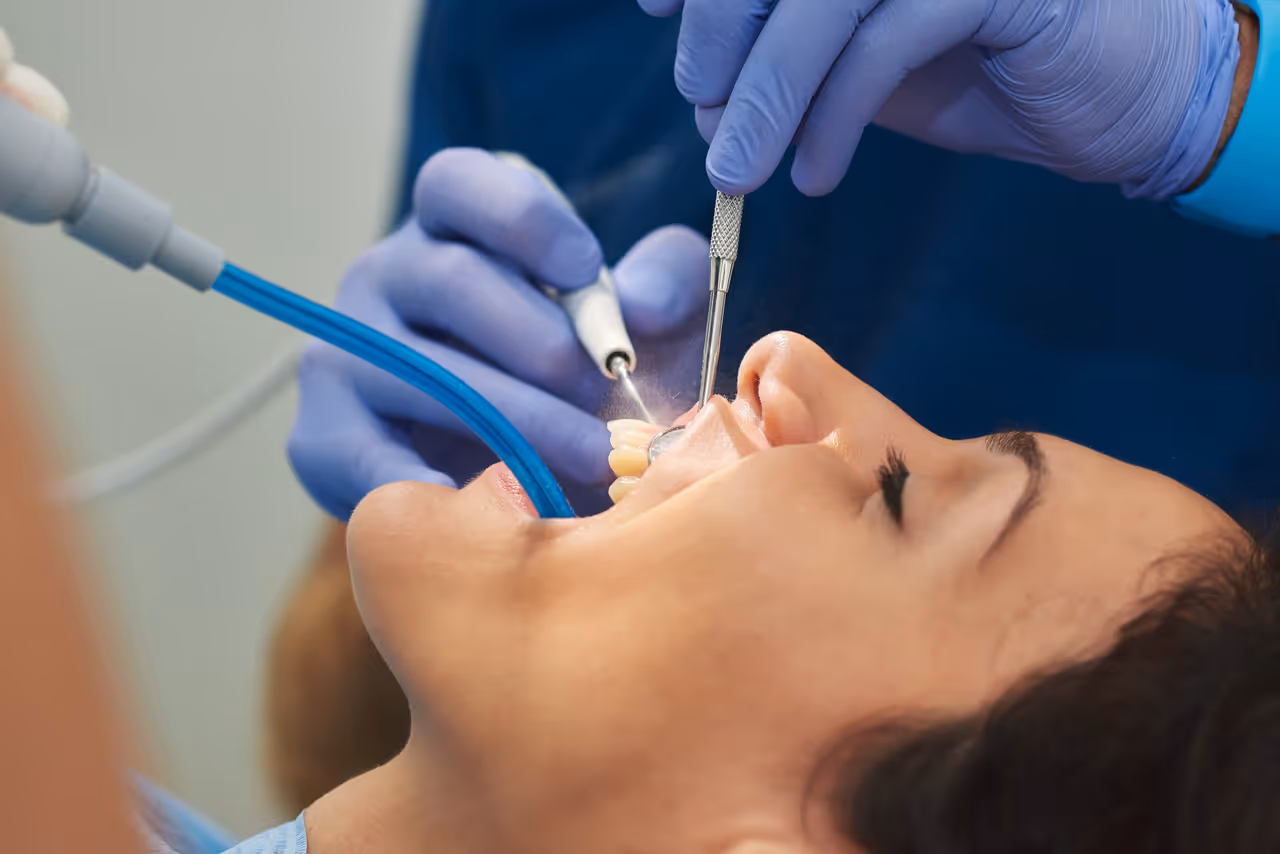 How to Care Best for Your Tooth After a Root Canal?: A Complete Guide