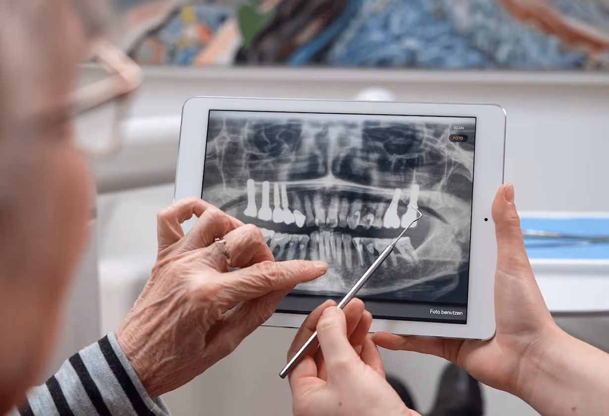 Ältere Person zeigt mit Stift auf Zahn-Implantat-Röntgenbild auf Tablet, während junge Person das Gerät hält.