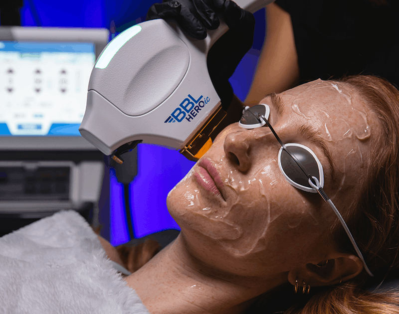 TRL tunable laser resurfacing for personalized skin rejuvenation in Jacksonville, Florida