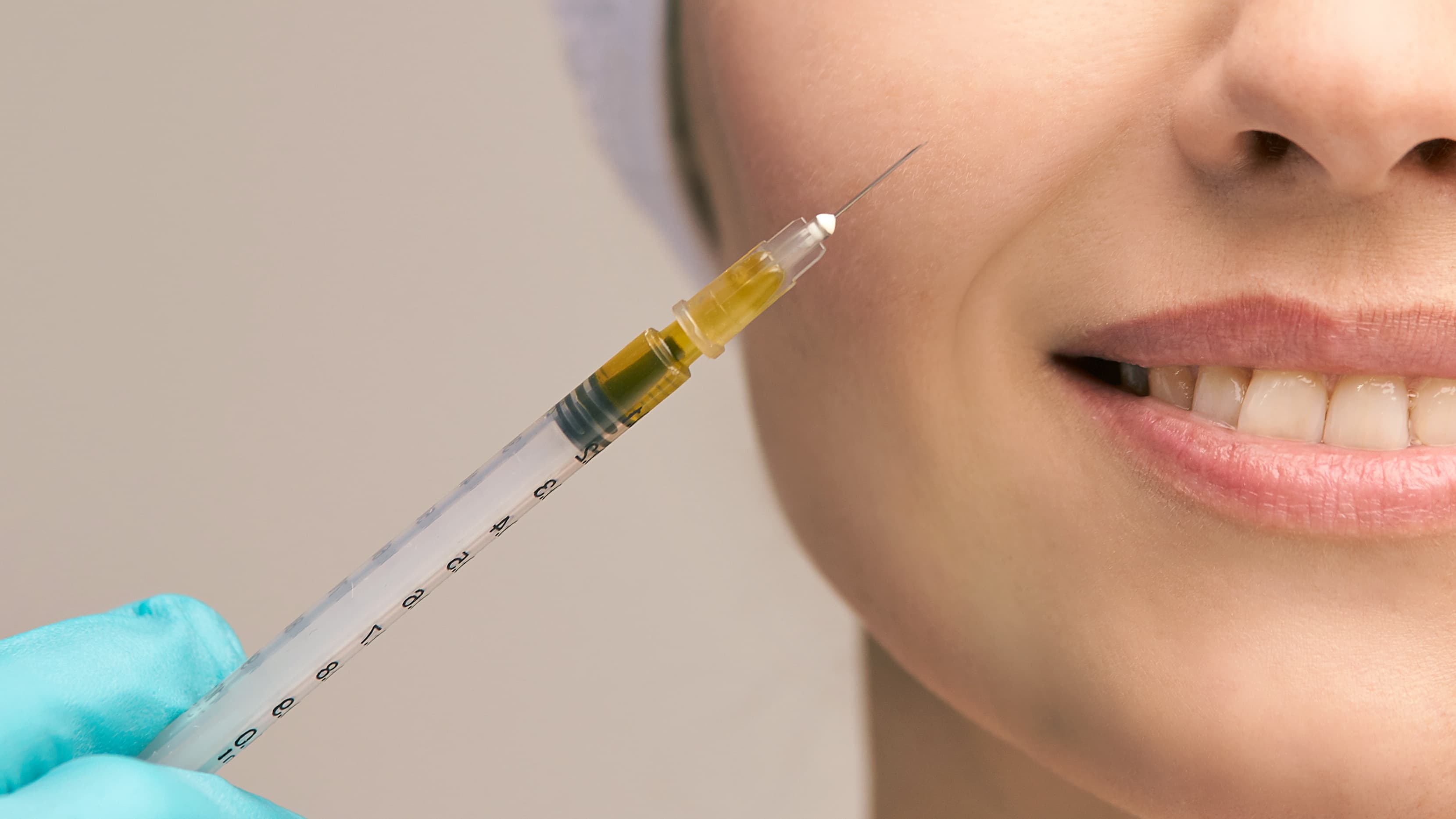 Close-up of refreshed under eye area after PRP therapy