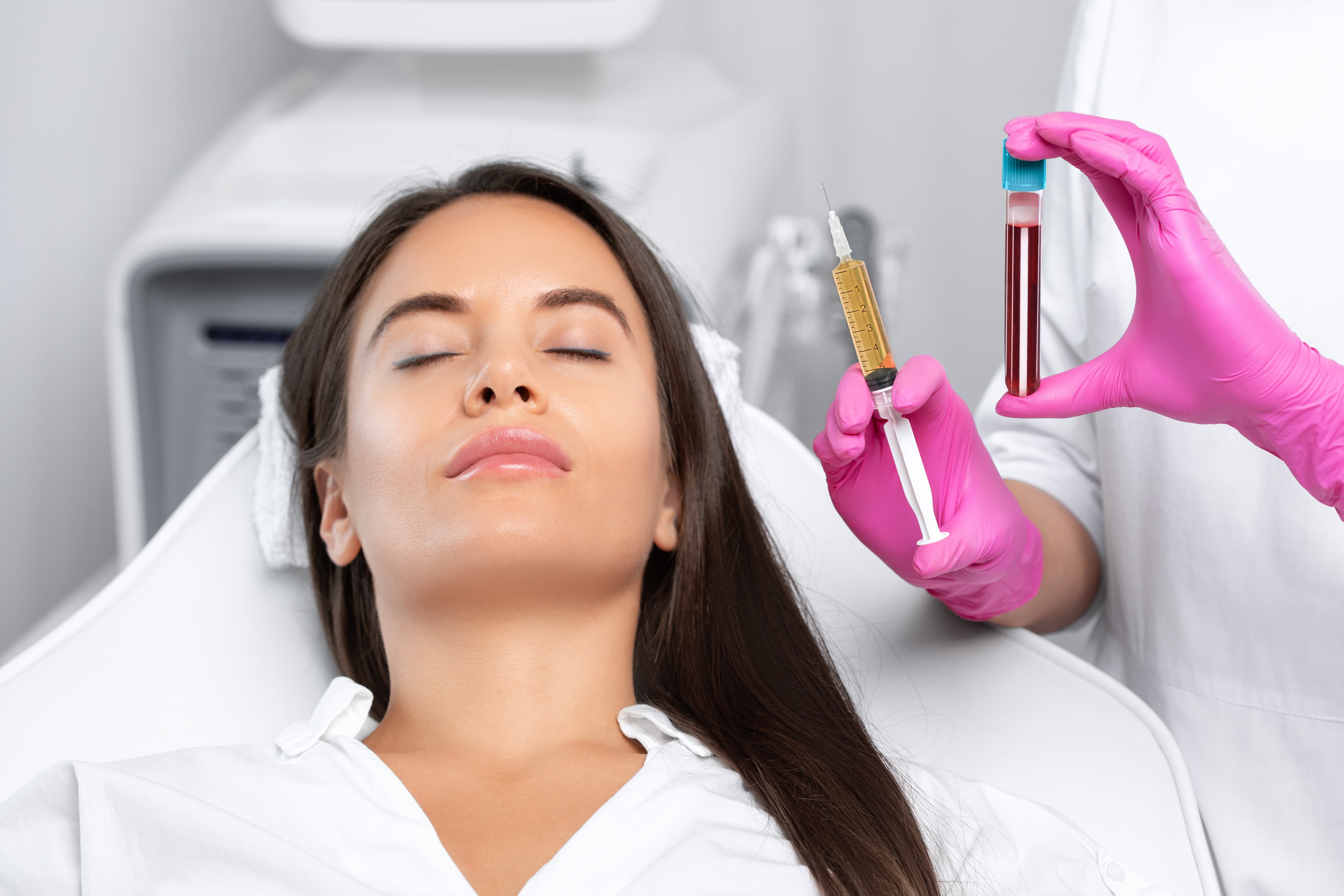 Platelet-rich plasma being prepared for a PRP treatment