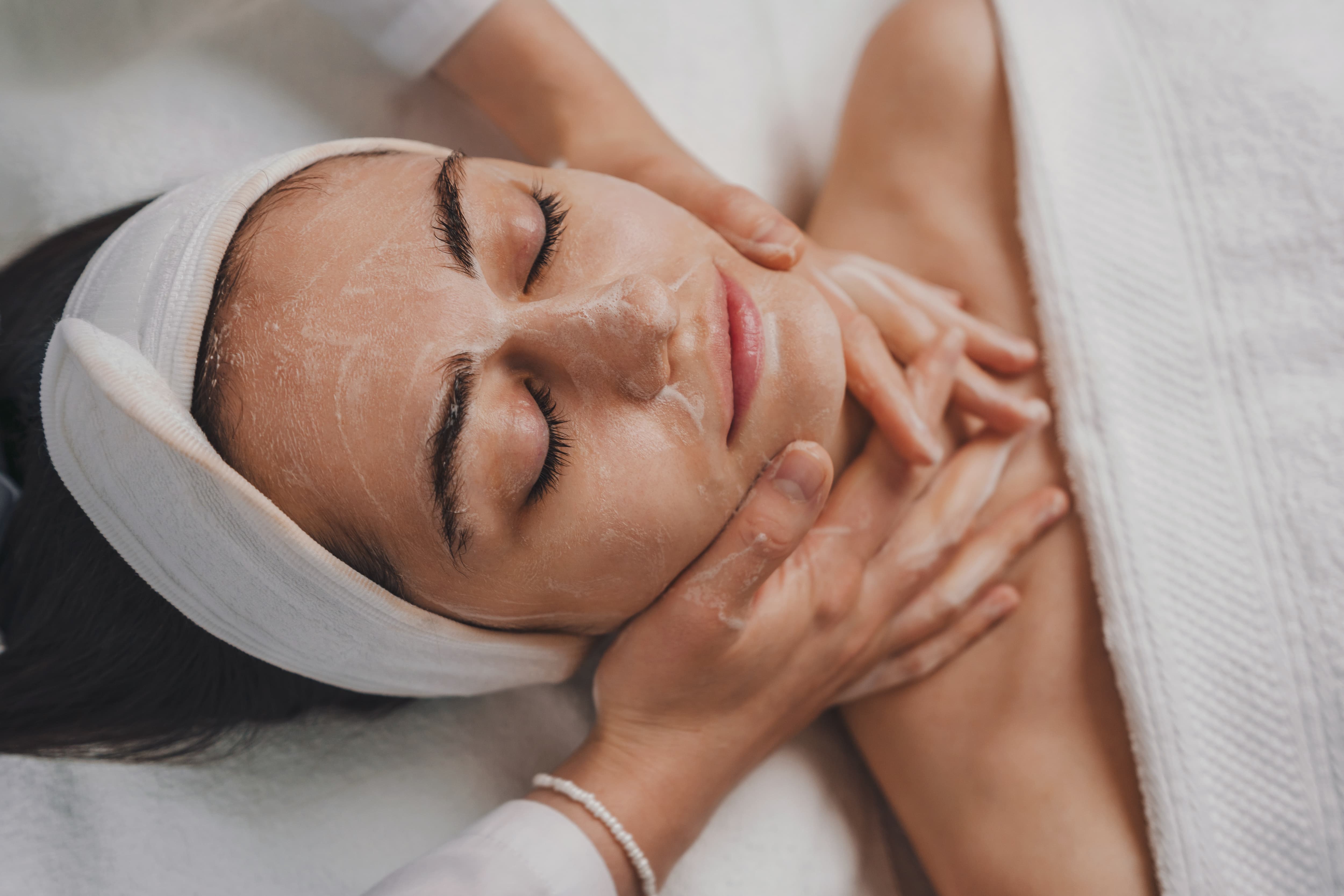 Brighter, more even complexion after a chemical peel