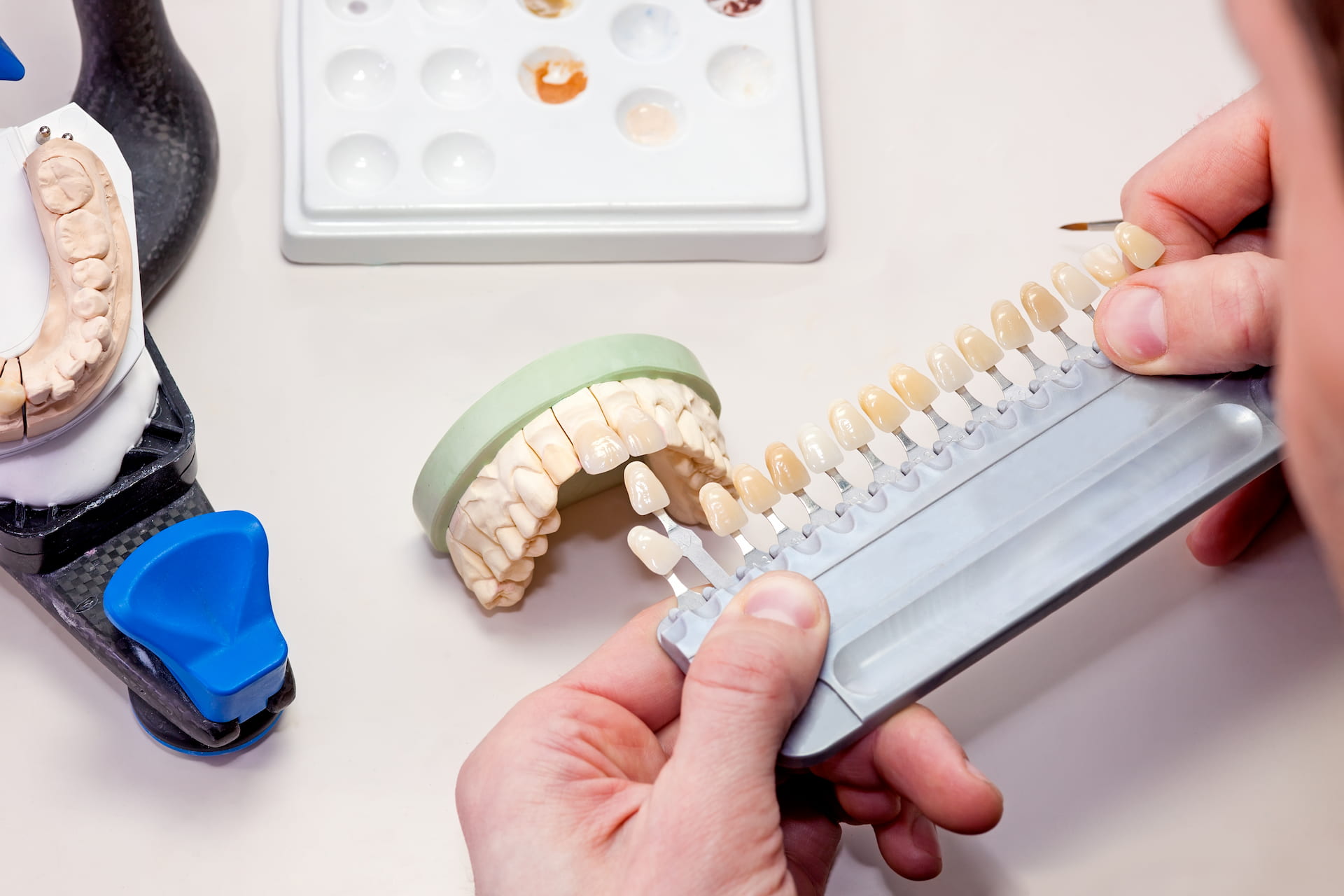Restorative dentistry at Bryan Ritchey DDS in Memorial Villages Houston