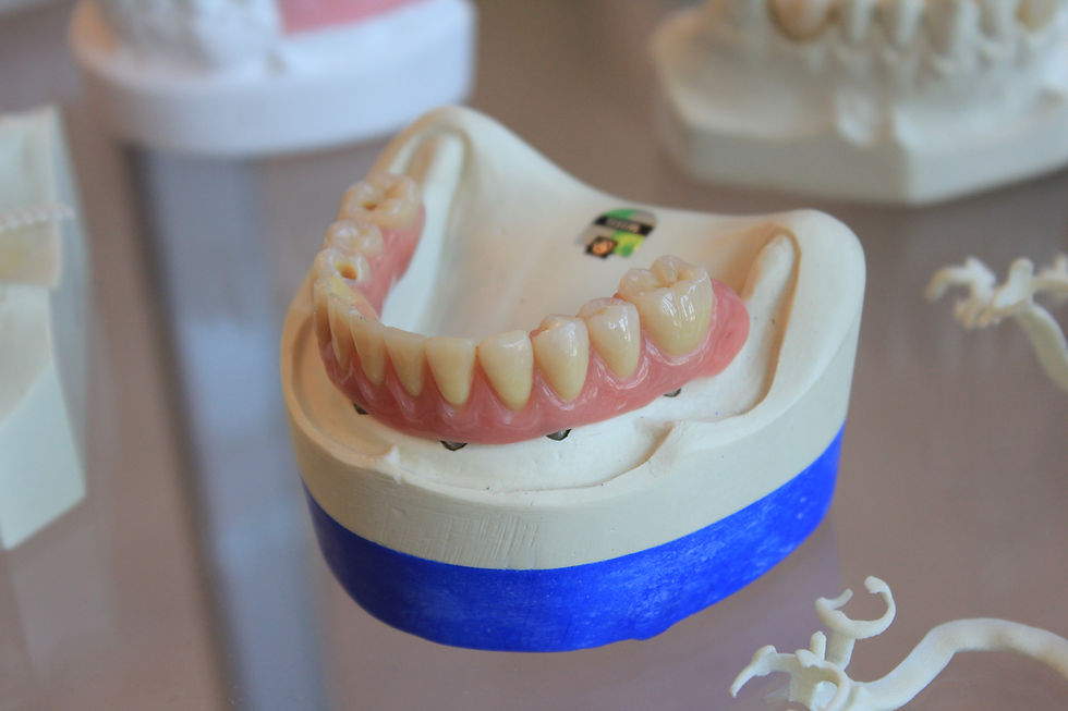 dental implants