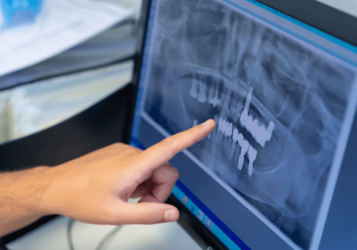 oral surgery plan