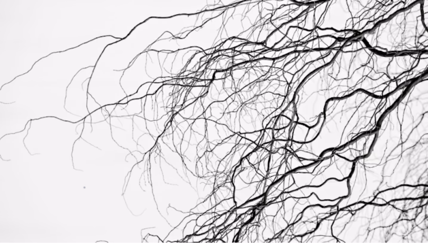Black intricate branching pattern resembling tree branches or neuron-like structures on a white background.