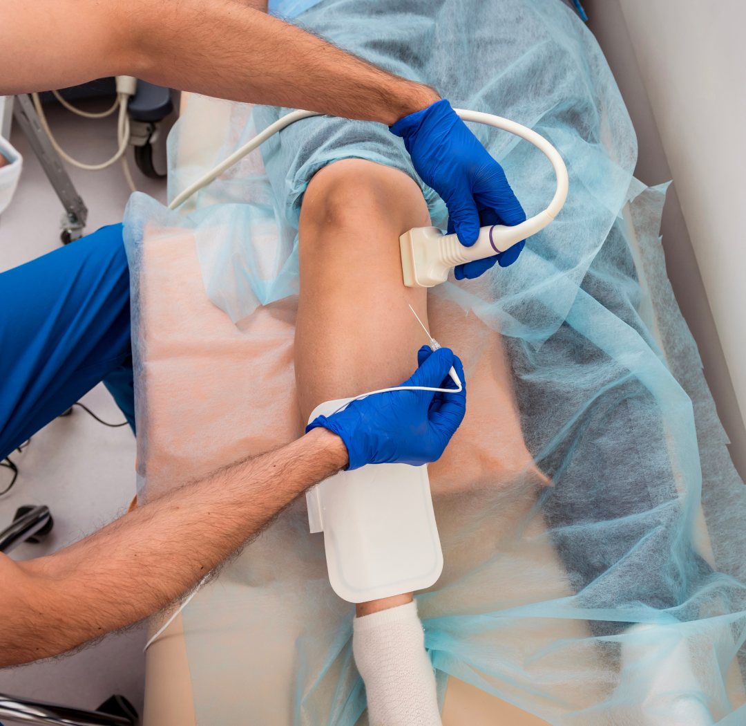 vein treatment