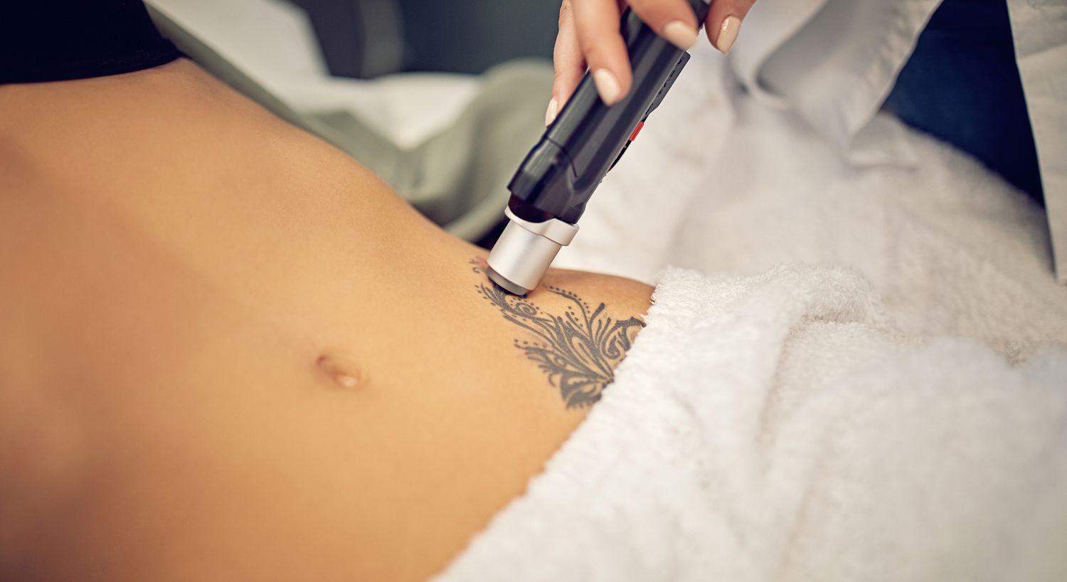 Laser Tattoo Removal at Belcara Health in Baltimore, MD