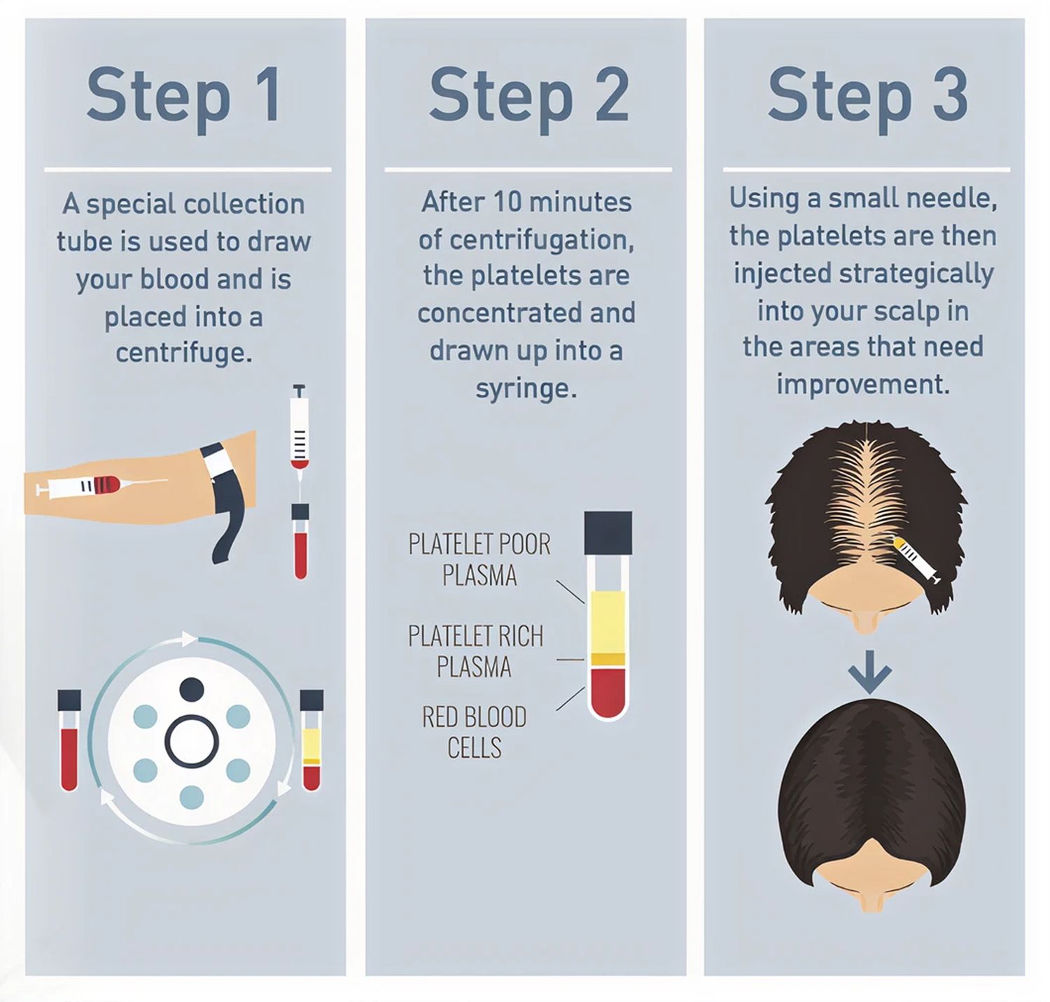 Step 1: An illustration of a hand holding a special collection tube filled with blood, placed next to a centrifuge with vials. Step 2: A diagram showing a centrifuge with a labeled syringe containing concentrated platelets, with text explaining the.