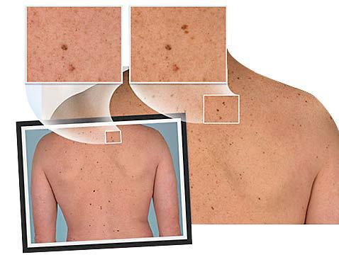 plastic surgery featured image for blog for Belcara Health in Baltimore, MD