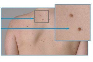 What is Body Mapping?