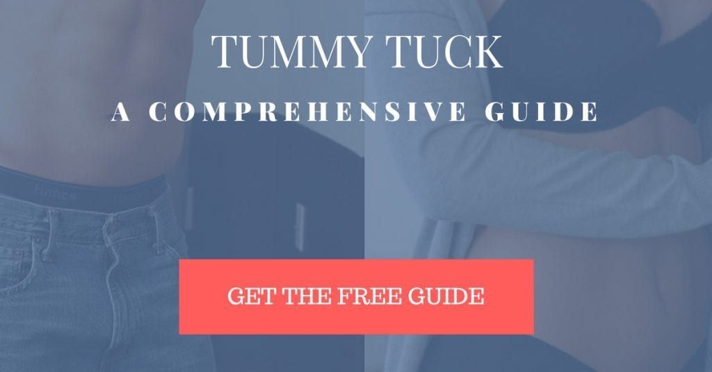 Tummy Tuck Ebook Download