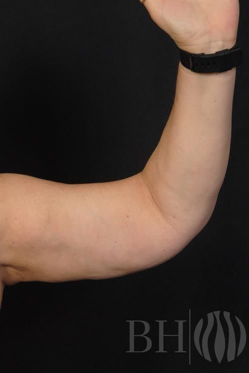 A close-up side view of a person's bent arm showing the bicep and upper arm area, with a black watch or fitness tracker on the wrist. A watermark logo reading 'BH' with a flame or leaf icon is visible in the bottom right corner.