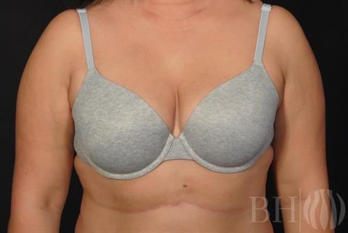 Front view of a woman's torso wearing a gray heather molded-cup bra with thin shoulder straps, featuring the 'BH' watermark logo in the lower right corner.