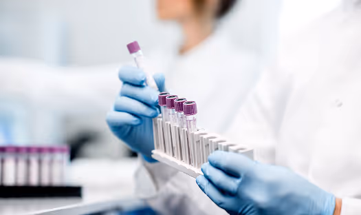 Lab technician wearing blue gloves holding a rack of test tubes with purple caps in a clinical setting.