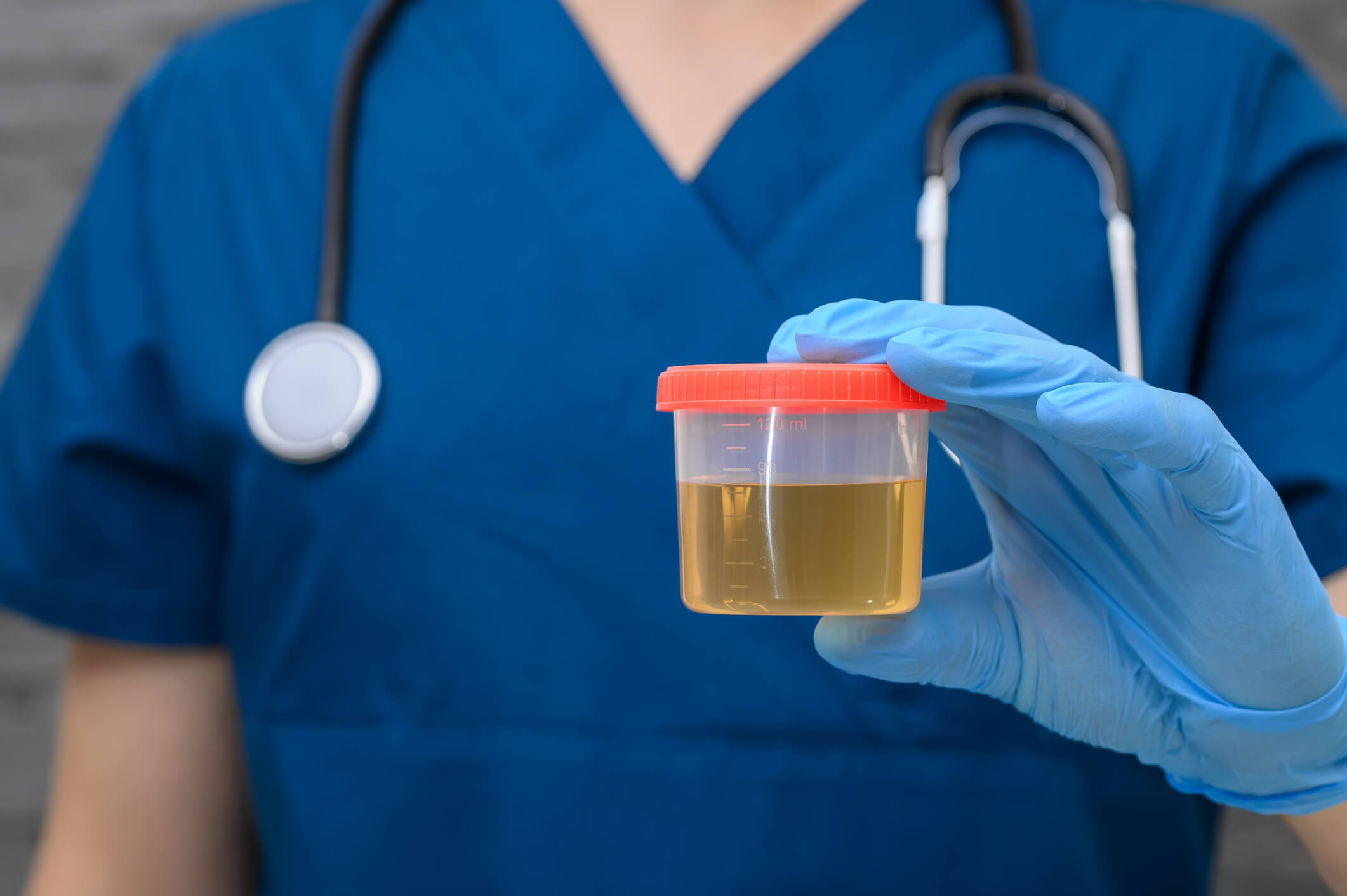 At-home urine collection for the Organic Acids Test