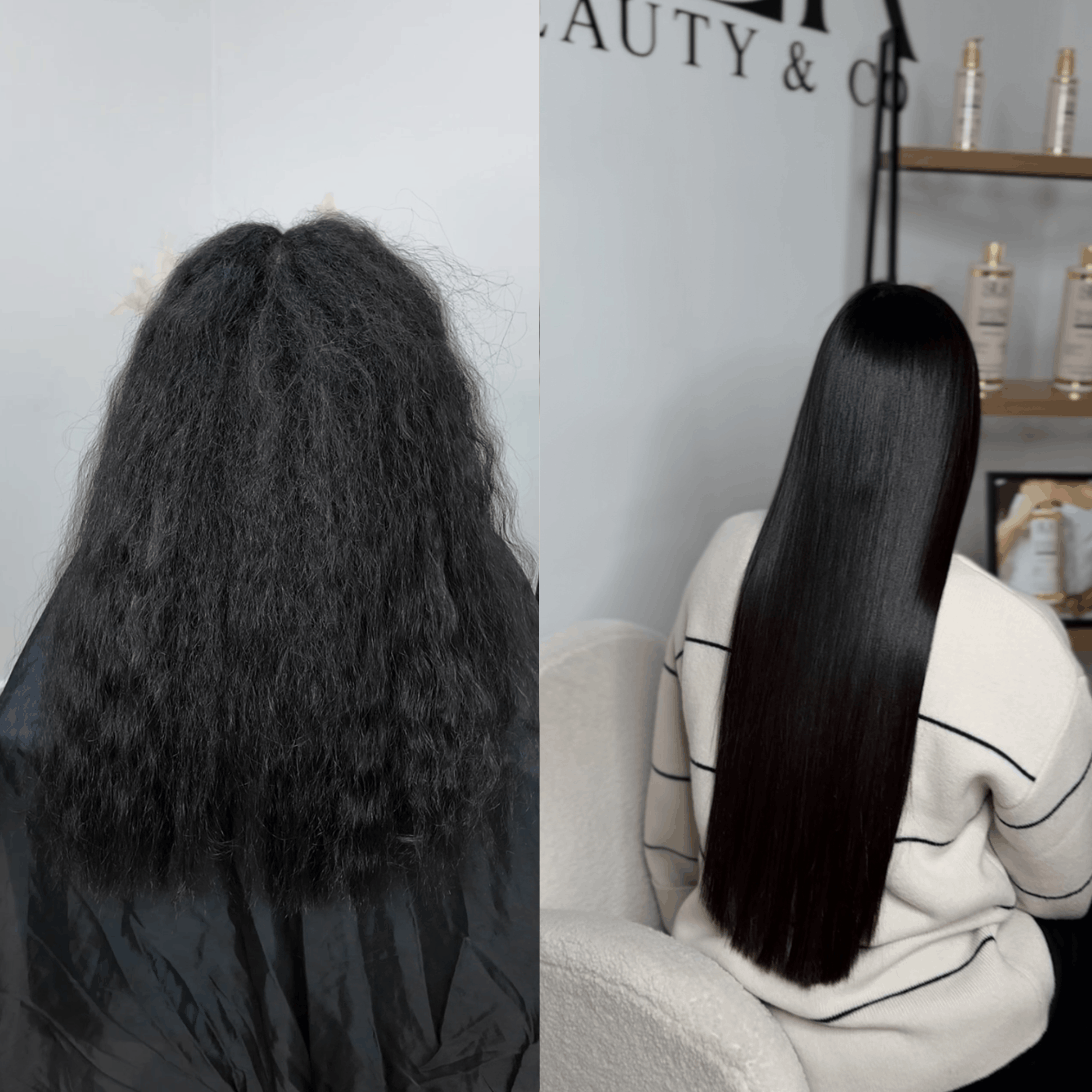 Nanoplasty before and after 4