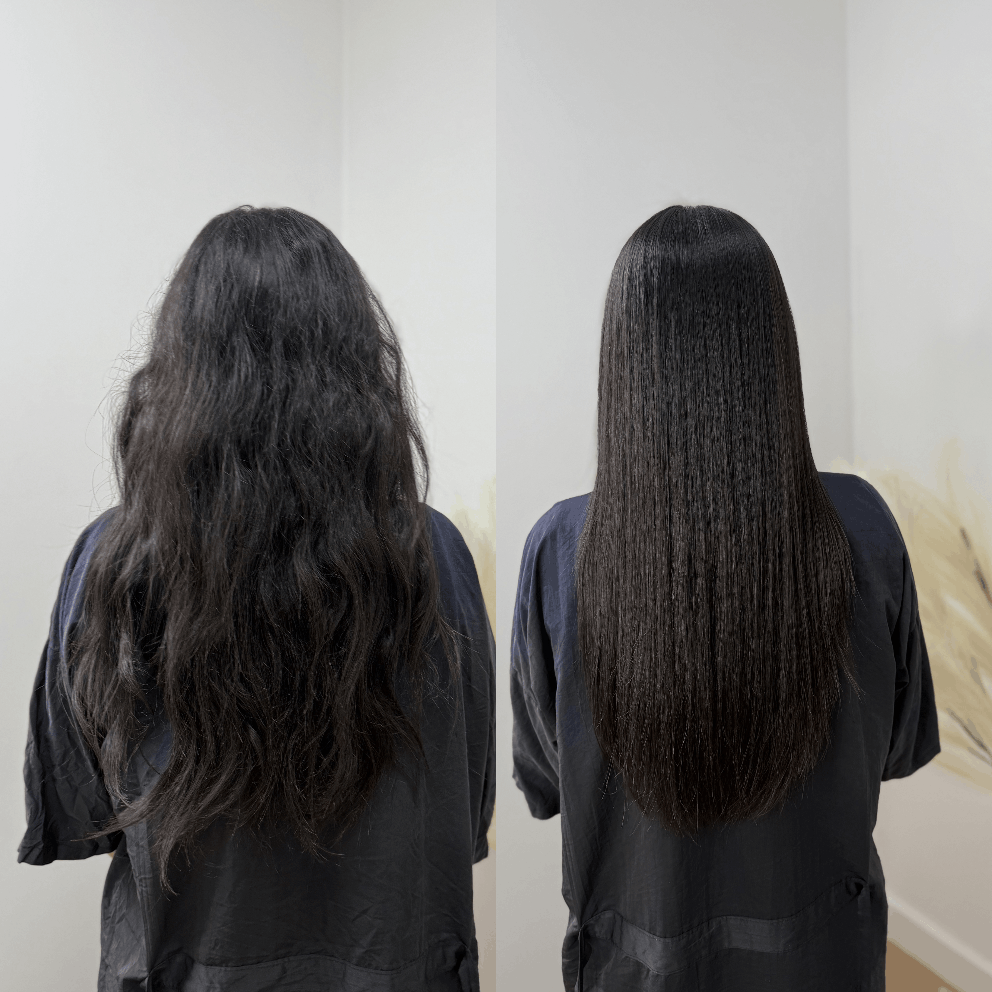 Nanoplasty before and after 1