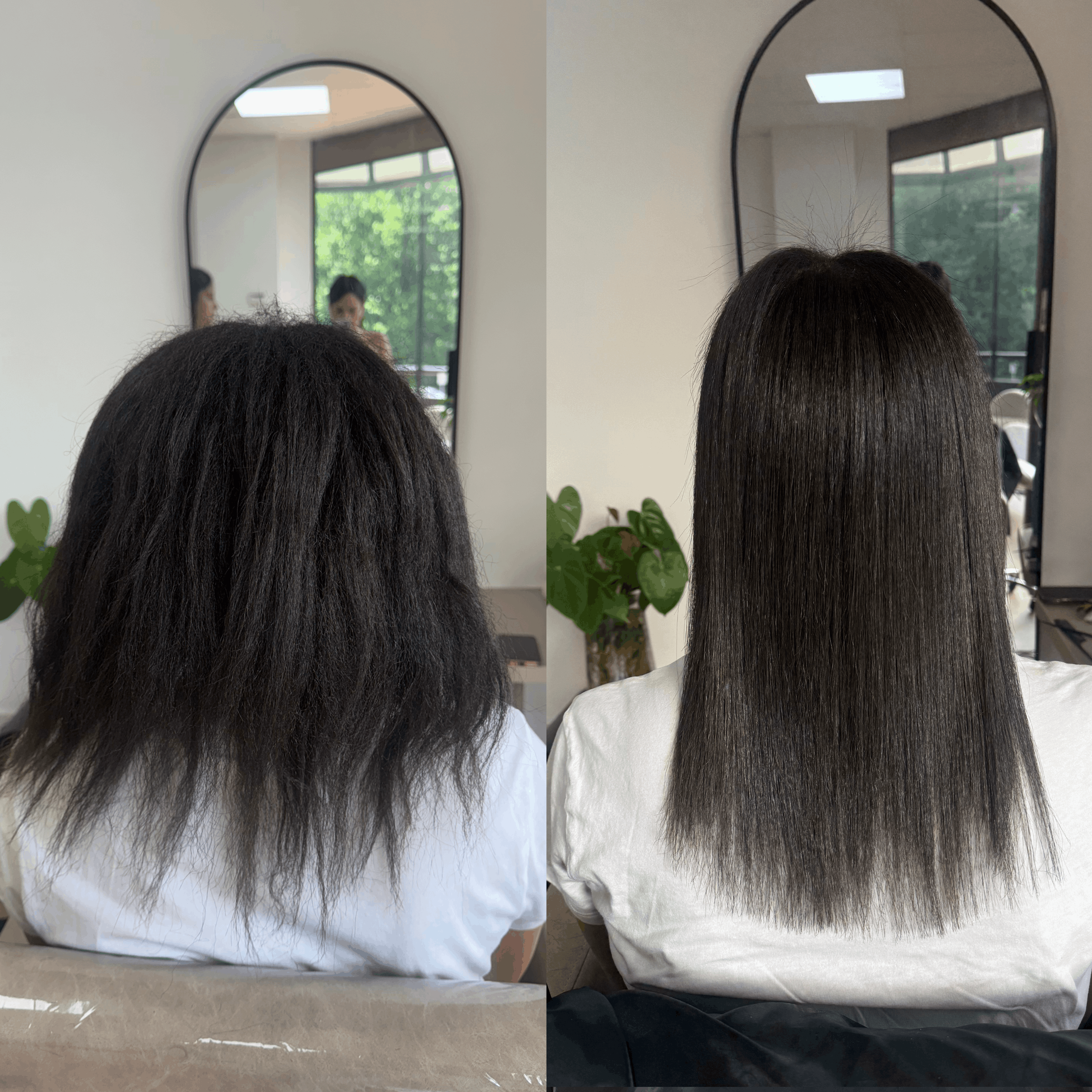 Nanoplasty before and after 5