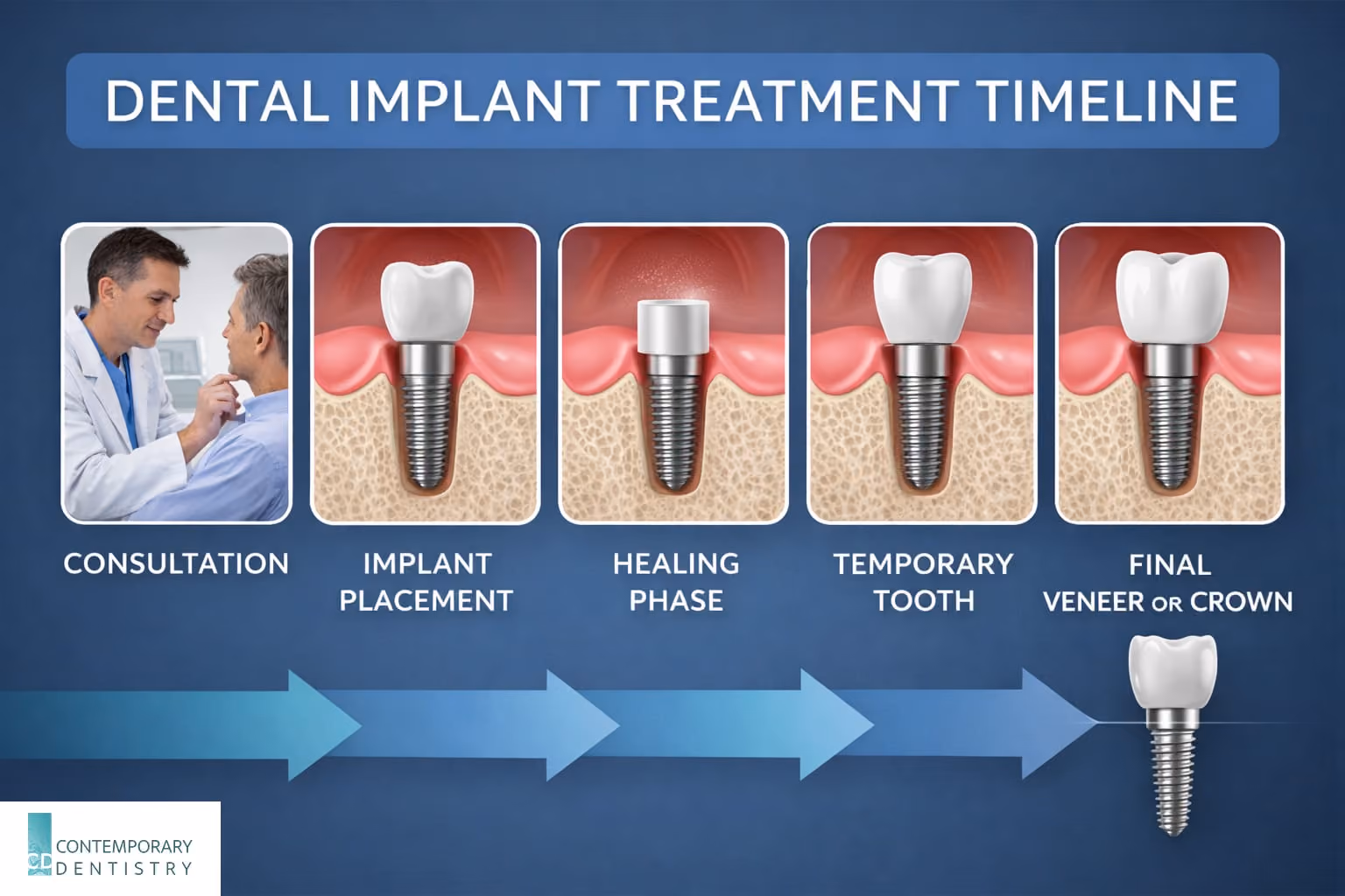 Infographic showing the dental implant treatment timeline including consultation, implant placement, healing phase, temporary tooth, and final crown placement.