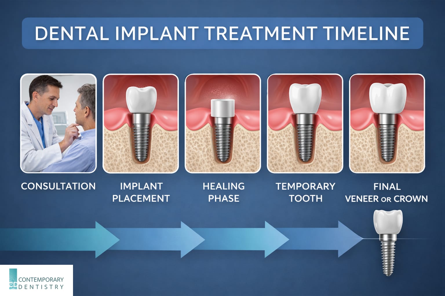 Infographic showing the dental implant treatment timeline including consultation, implant placement, healing phase, temporary tooth, and final crown placement.