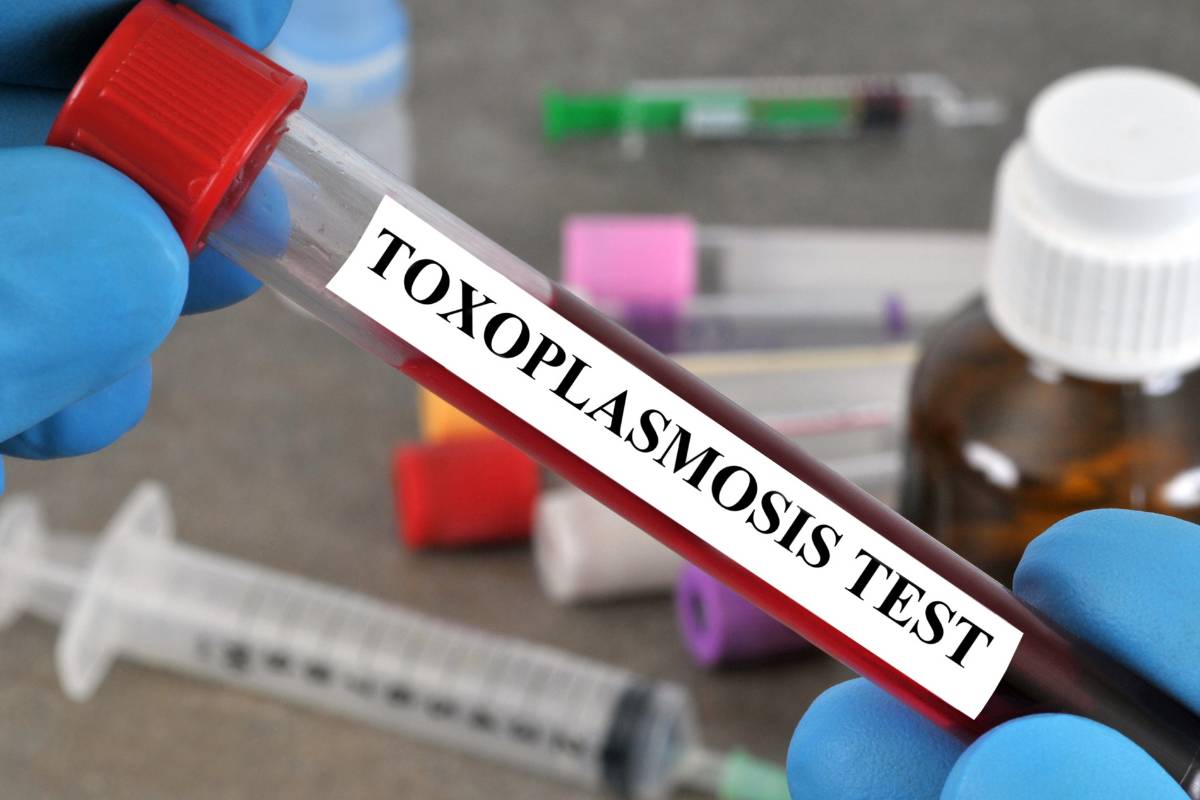 Toxoplasmose und Listeriose