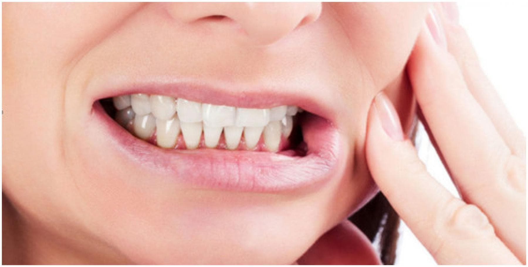 Bruxism