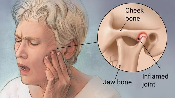 TMJ Treatment