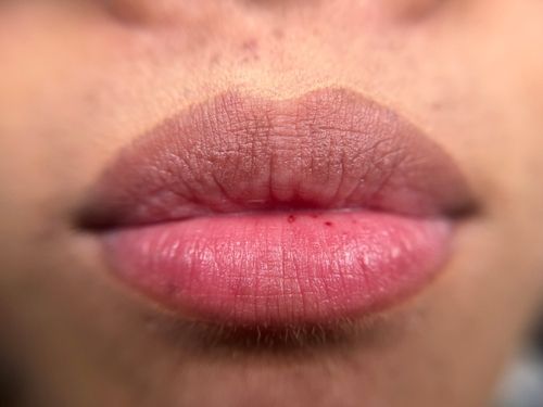 Healed Lip Blushing