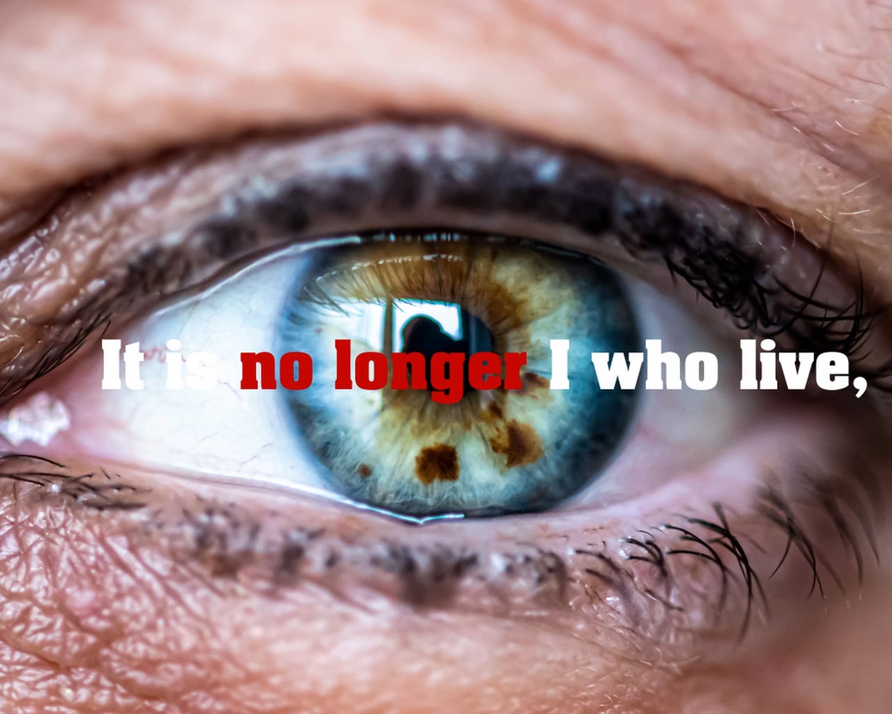 Thumbnail for Muslim Man Lost Vision