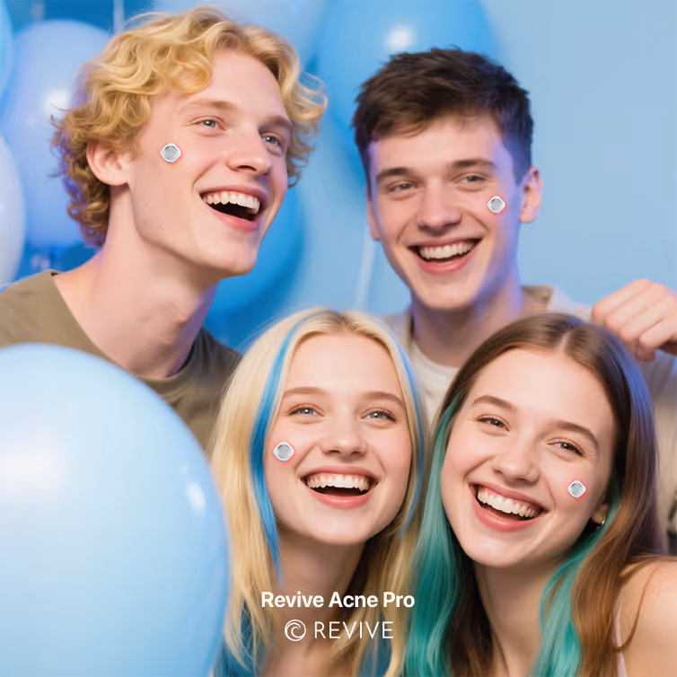 Cuatro jóvenes sonrientes con puntos marcados en sus mejillas, rodeados de globos azules, con el texto Revive Acne Pro.