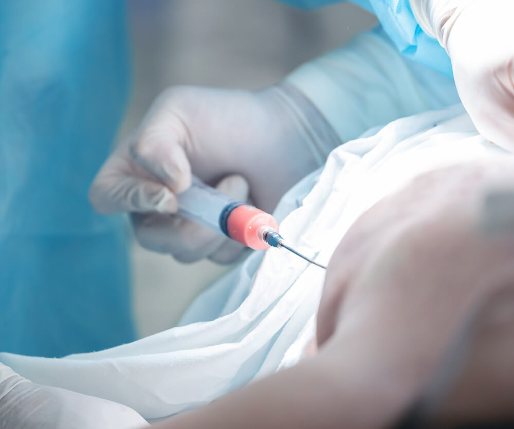 A male patient lying shirtless on a treatment bed wearing a disposable hair net, while a medical professional in a white lab coat and blue latex gloves applies a body sculpting device to his abdomen in a clinical setting.