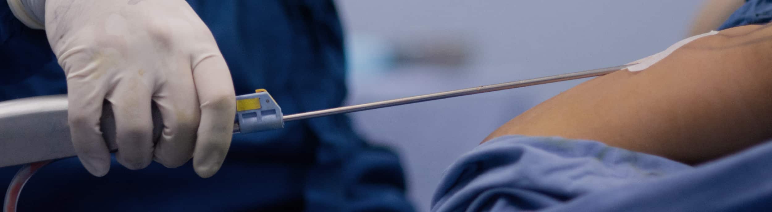 A male patient lying shirtless on a treatment bed wearing a disposable hair net, while a medical professional in a white lab coat and blue latex gloves applies a body sculpting device to his abdomen in a clinical setting.