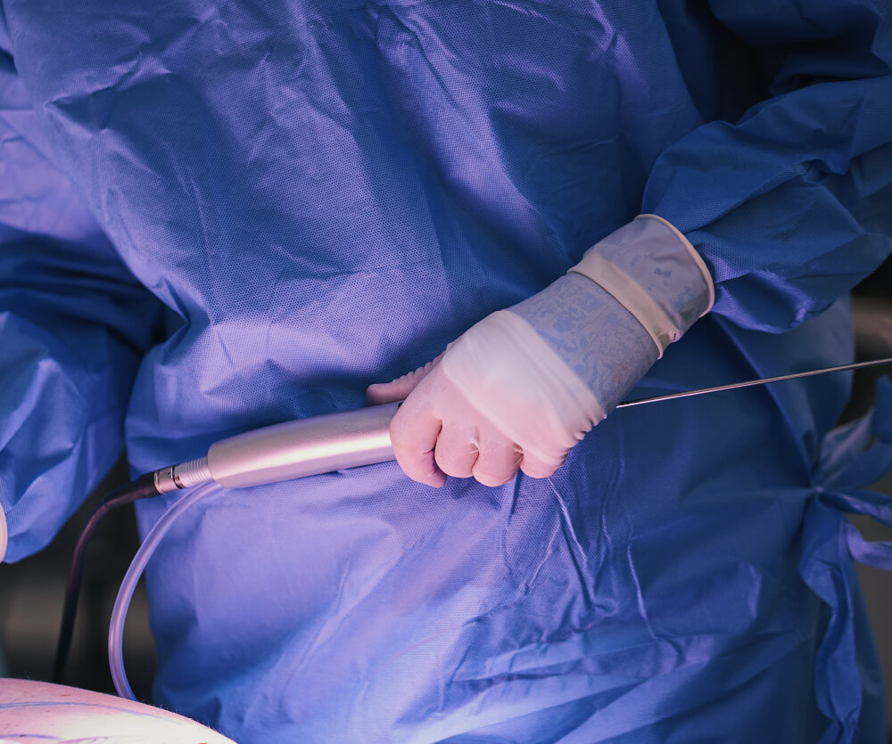 A male patient lying shirtless on a treatment bed wearing a disposable hair net, while a medical professional in a white lab coat and blue latex gloves applies a body sculpting device to his abdomen in a clinical setting.