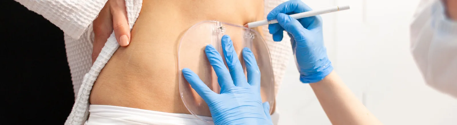 A medical professional wearing blue latex gloves holding a clear silicone breast implant against a patient's torso, while another gloved hand holds a surgical marking pen, illustrating how VASER liposuction or a body contouring procedure works.