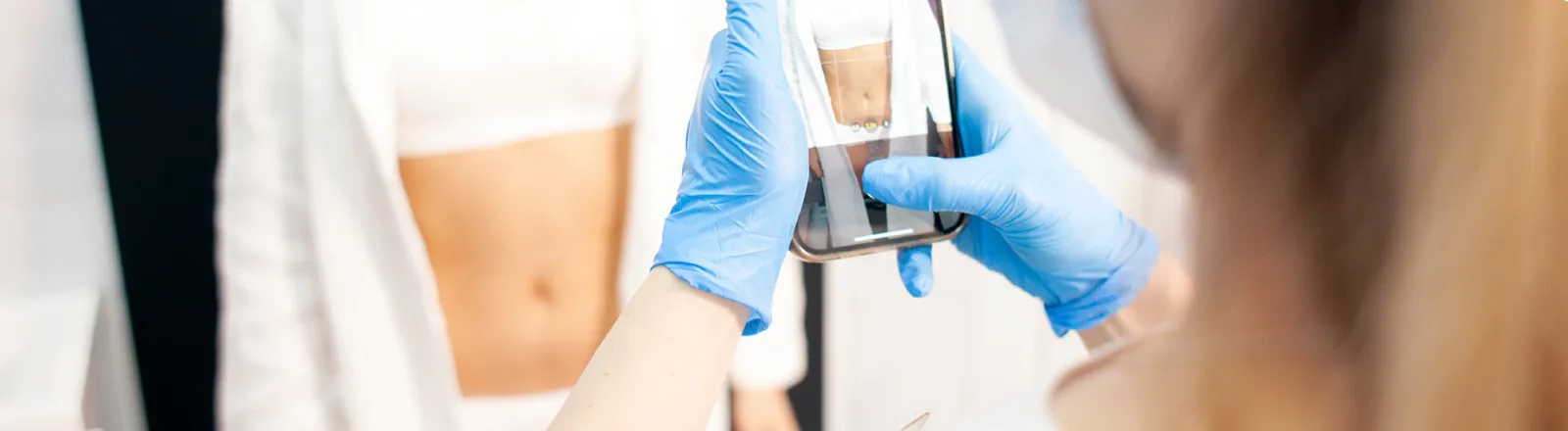A medical professional wearing blue latex gloves uses a handheld device on a patient's arm, with the patient's midsection visible in the background, in a clinical setting related to a liposuction consultation or body assessment procedure.
