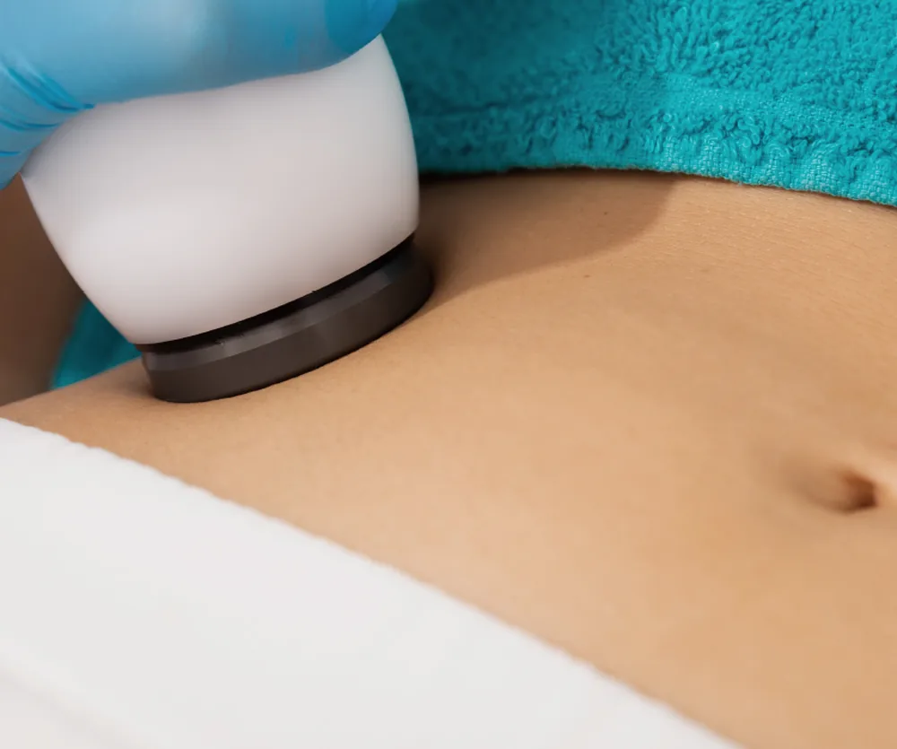 A male patient lying shirtless on a treatment bed wearing a disposable hair net, while a medical professional in a white lab coat and blue latex gloves applies a body sculpting device to his abdomen in a clinical setting.