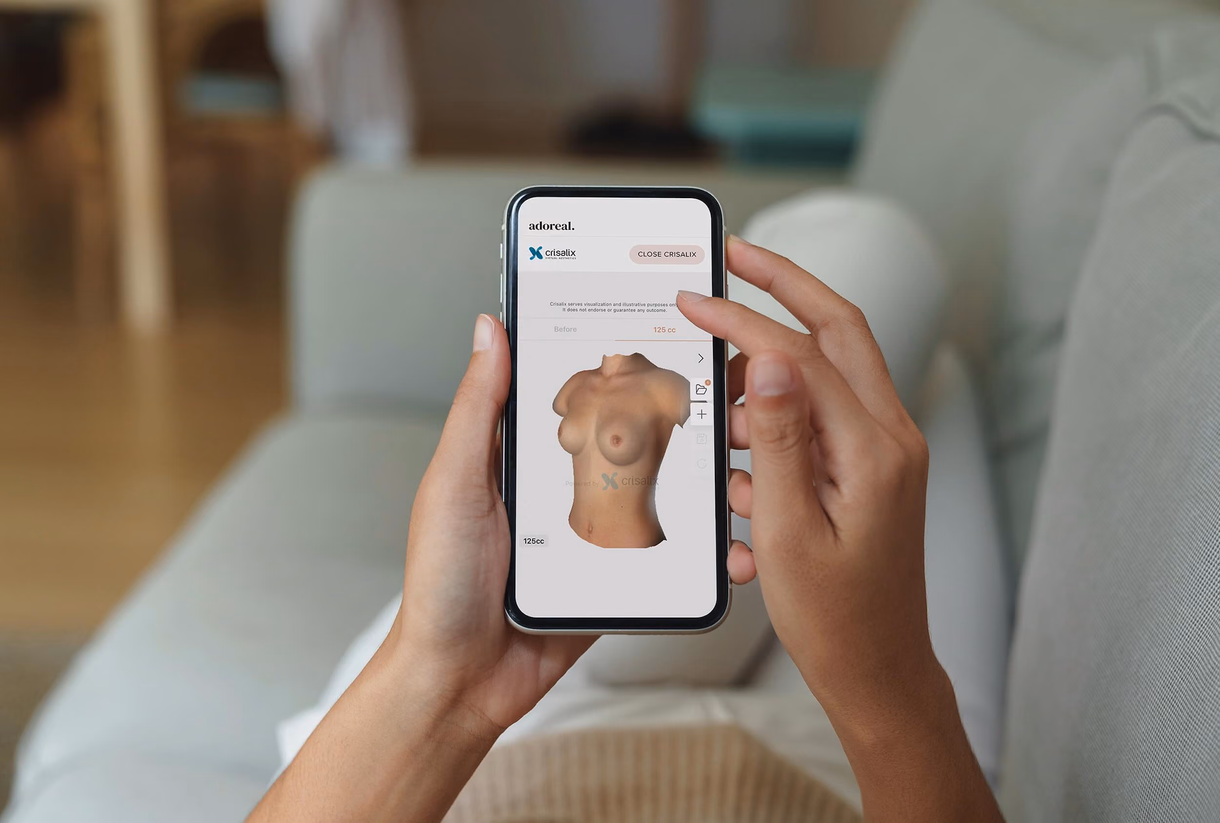A person holding a smartphone with both hands, interacting with the Adoreal app, which displays a 3D model of a female torso used for breast augmentation surgical simulation and planning.