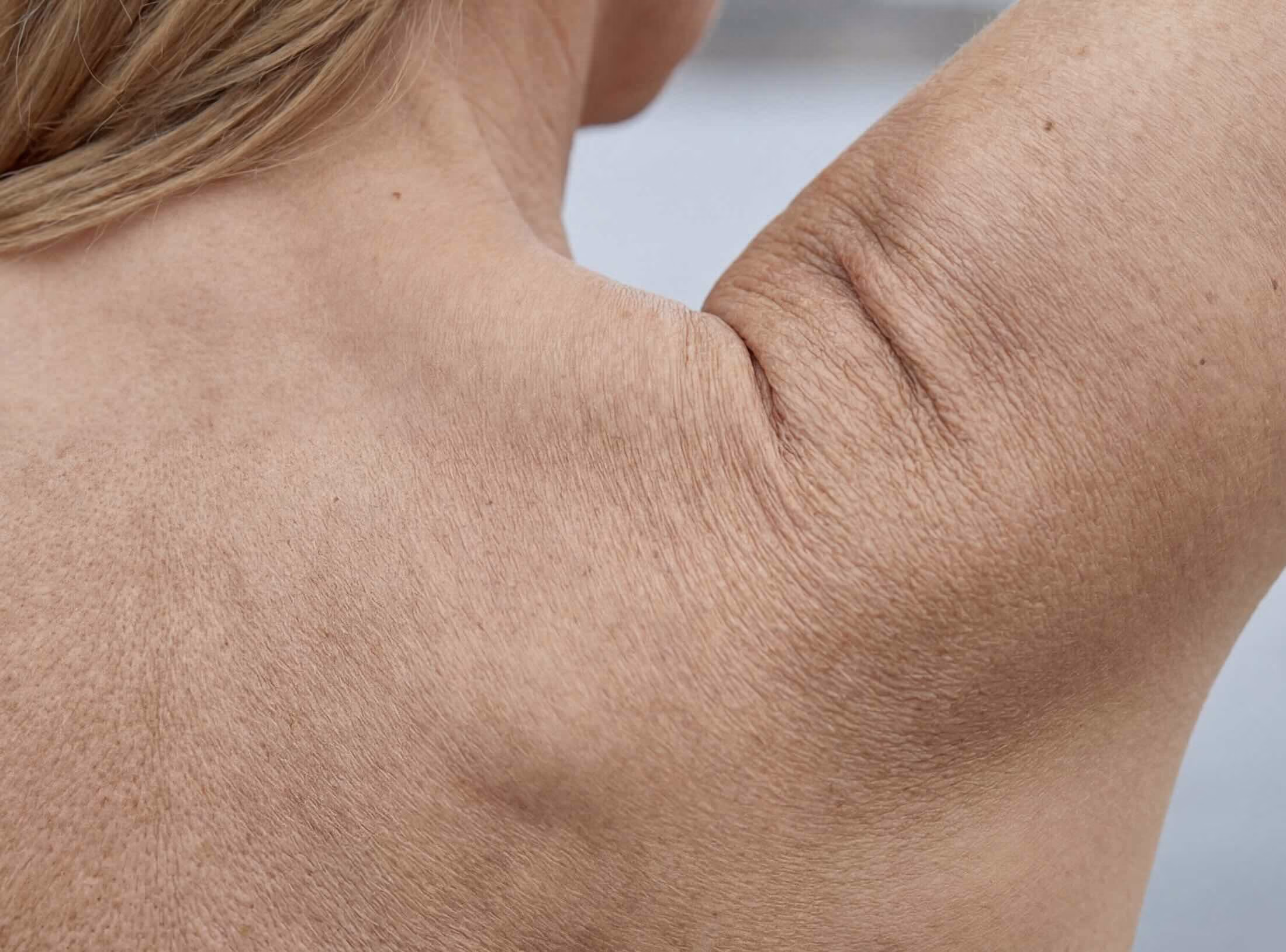 Close-up view of the back and underarm area of a person with fair skin and blonde hair, arm raised to reveal the armpit and shoulder area, showing natural skin texture and fine lines.
