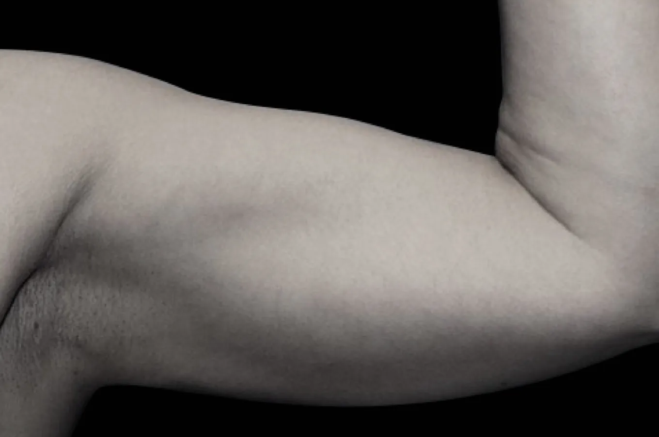 Kvinnlig arm framifrån efter EMSCULPT-behandling med BTL, som visar definierad muskulatur.