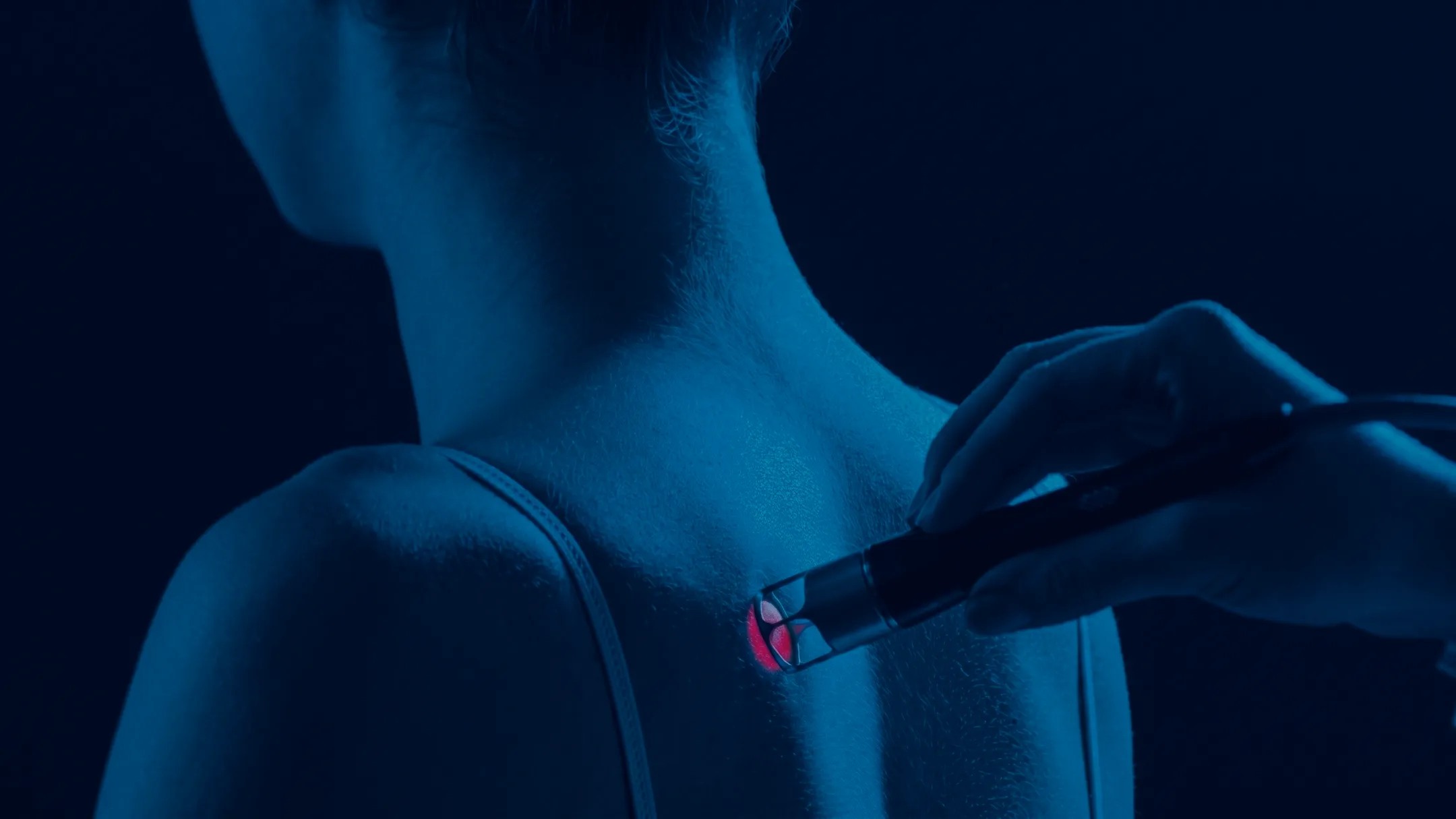 Sjukvardspersonal applicerar BTL High Intensity Laser laserterapi på patientens skuldra och nacke under behandling.