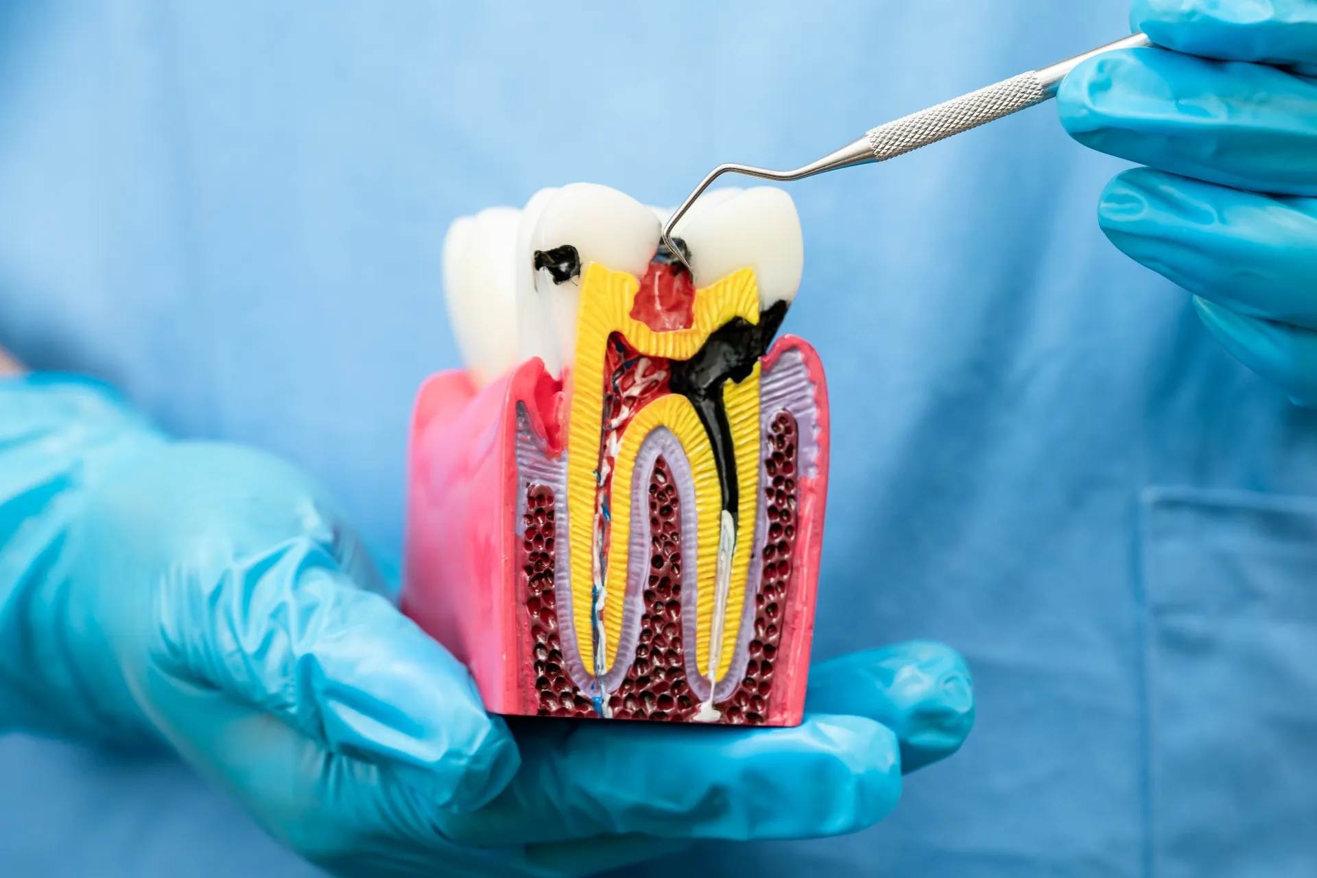 Patient relaxing comfortably after a successful, pain-free root canal treatment at Nova Dental Care of Chantilly