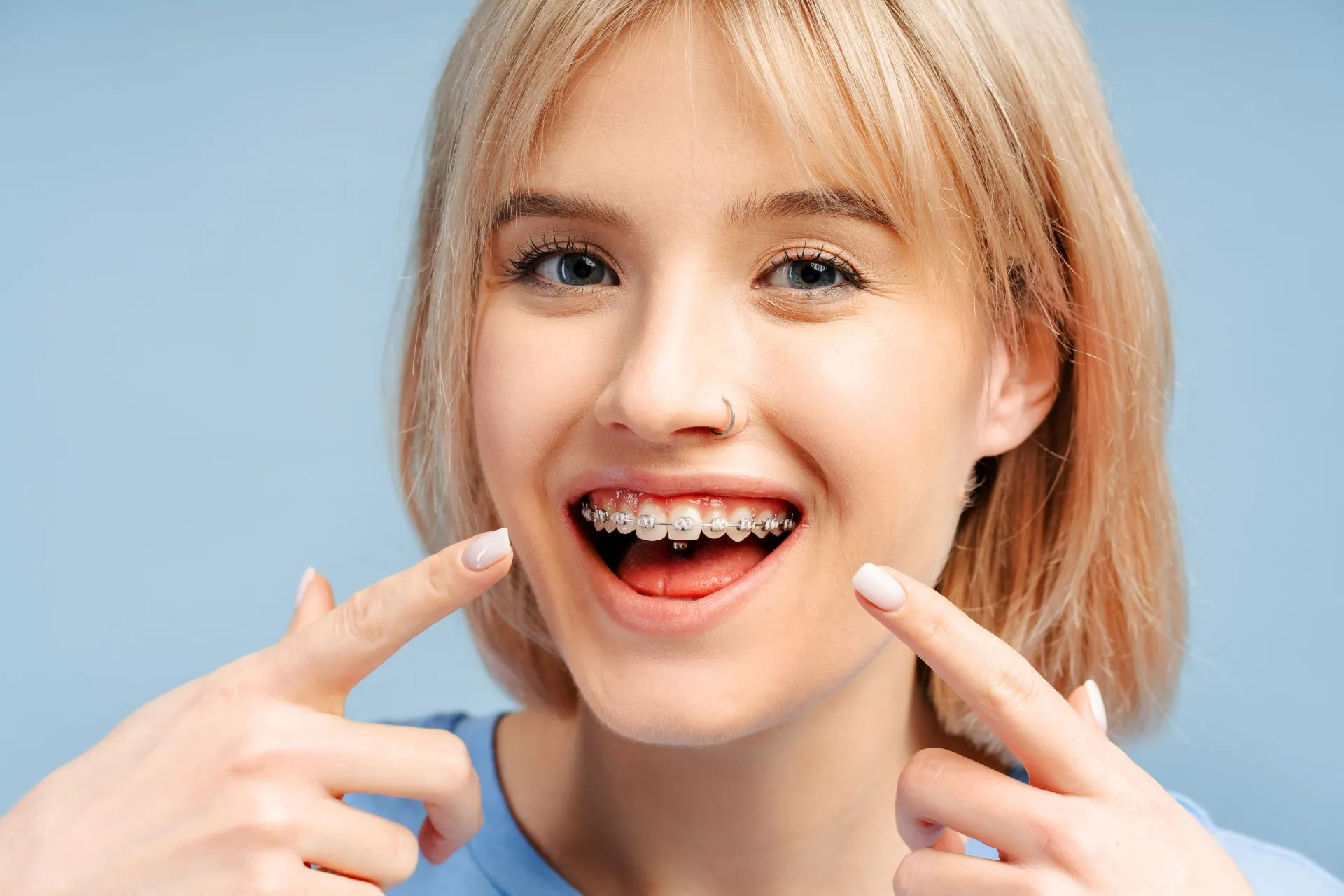 Teen patient smiling with traditional metal braces during orthodontic treatment at Nova Dental Care of Chantilly