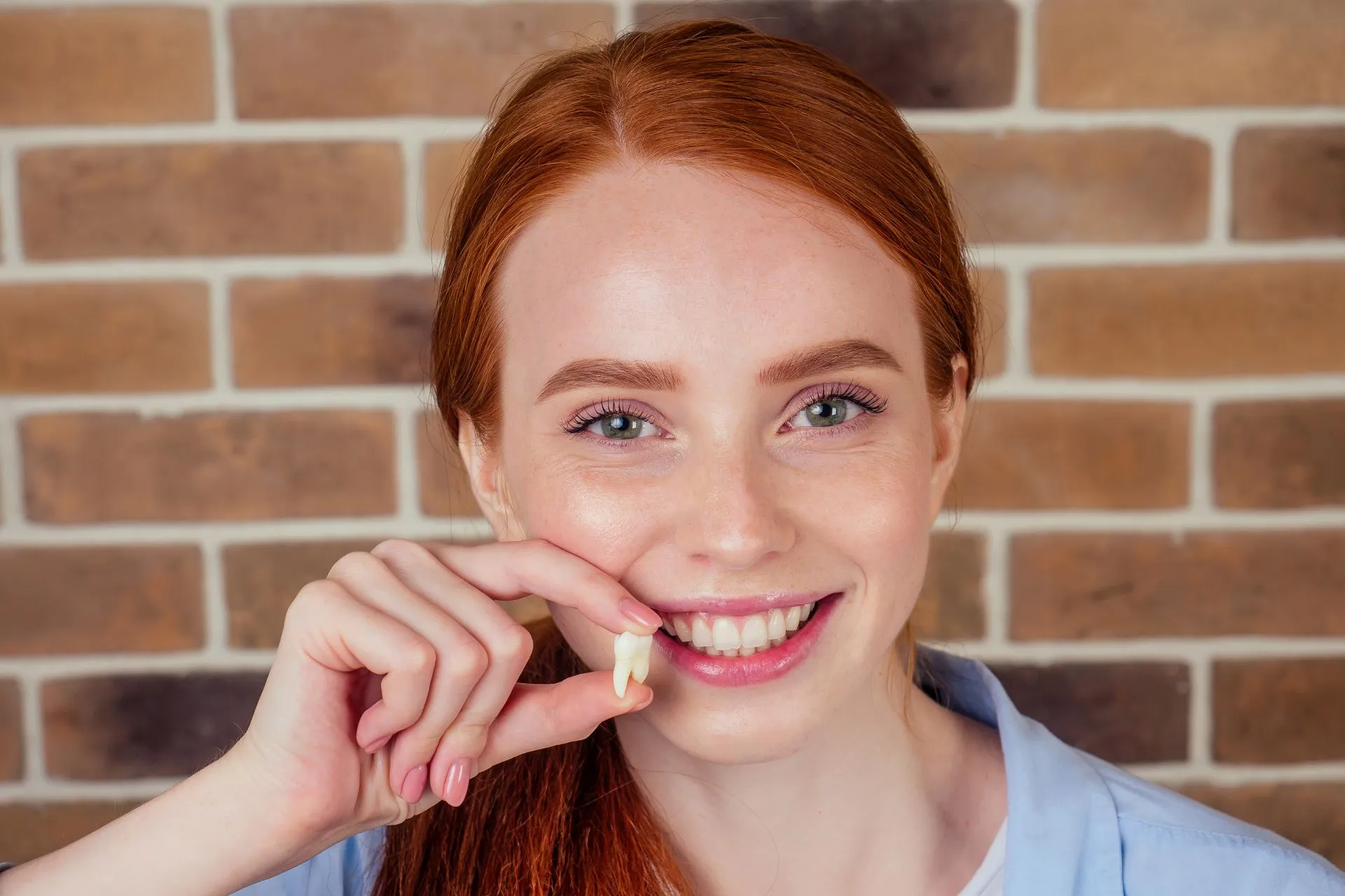 Dental X-ray showing impacted wisdom teeth requiring extraction at Nova Dental Care of Chantilly