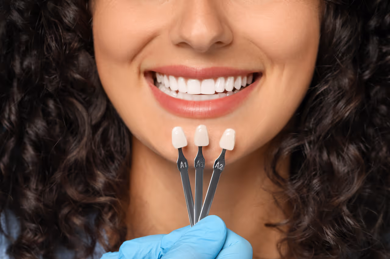 Can I Get Veneers If My Teeth Aren’t Straight?