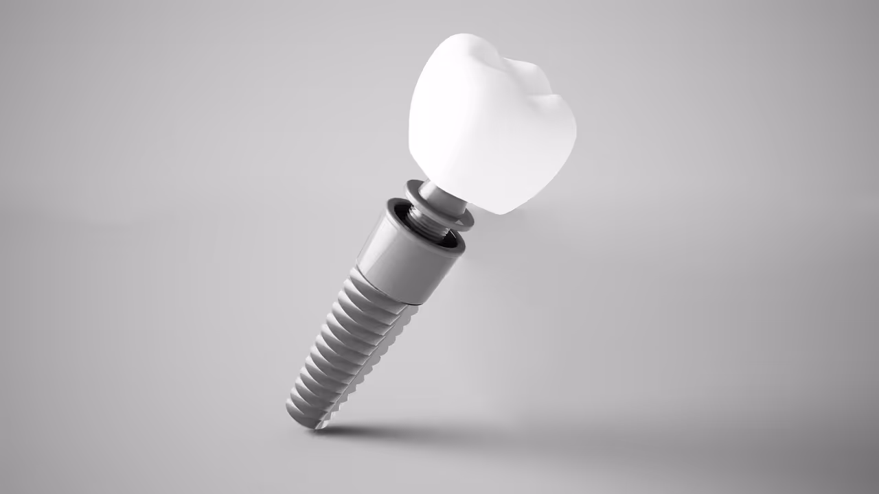 How Dental Implants Help Preserve Your Jawbone and Facial Shape?
